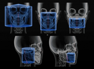 Diagnostyka radiologiczna 2D