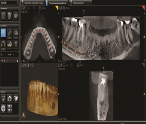 Tomograf 3D