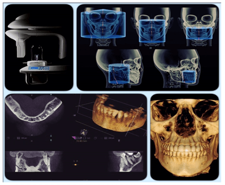 Tomograf 3D